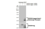 beta-2 Adrenergic Receptor Antibody in Western Blot (WB)