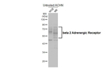 beta-2 Adrenergic Receptor Recombinant Rabbit Monoclonal Antibody (HL4320)