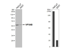 VPS4B Recombinant Rabbit Monoclonal Antibody (HL4340)