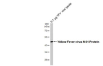 Yellow Fever Virus NS1 Recombinant Rabbit Monoclonal Antibody (HL4344)