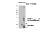 beta-2 Adrenergic Receptor Antibody in Western Blot (WB)