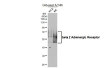 beta-2 Adrenergic Receptor Recombinant Rabbit Monoclonal Antibody (HL4346)