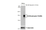 Phospho-GCN2 (Thr899) Recombinant Rabbit Monoclonal Antibody (HL4355)