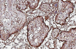 CD63 Antibody in Immunohistochemistry (Paraffin) (IHC (P))