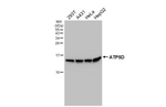 ATP5D Antibody in Western Blot (WB)