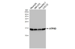 ATP5D Antibody in Western Blot (WB)