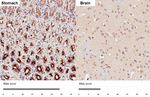 GALNT2 Antibody in Immunohistochemistry (Paraffin) (IHC (P))