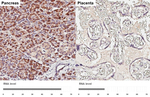 GALNT2 Antibody in Immunohistochemistry (Paraffin) (IHC (P))