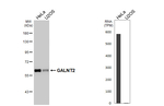 GALNT2 Antibody in Western Blot (WB)