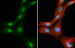 LOXL2 Recombinant Rabbit Monoclonal Antibody (HL4379)