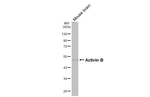 INHBB Antibody in Western Blot (WB)