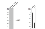 CCKBR Recombinant Rabbit Monoclonal Antibody (HL4404)
