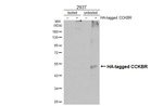 CCKBR Antibody in Western Blot (WB)