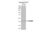 CCKBR Antibody in Western Blot (WB)