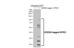GPR21 Recombinant Rabbit Monoclonal Antibody (HL4426)