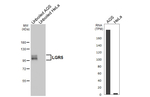 LGR5 Recombinant Rabbit Monoclonal Antibody (HL4443)