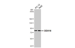 DDX18 Antibody in Western Blot (WB)