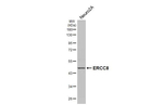 ERCC8 Antibody in Western Blot (WB)