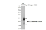 ERCC8 Antibody in Western Blot (WB)