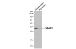 VDAC2 Antibody in Western Blot (WB)