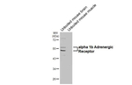 alpha-1b Adrenergic Receptor Antibody in Western Blot (WB)