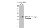 alpha-1b Adrenergic Receptor Antibody in Western Blot (WB)