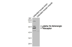 alpha-1b Adrenergic Receptor Antibody in Western Blot (WB)