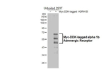 alpha-1b Adrenergic Receptor Antibody in Western Blot (WB)