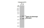 alpha-1b Adrenergic Receptor Antibody in Western Blot (WB)