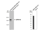 GPR116 Recombinant Rabbit Monoclonal Antibody (HL4482)