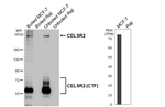 CELSR2 Recombinant Rabbit Monoclonal Antibody (HL4484)