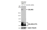 CELSR2 Antibody in Western Blot (WB)