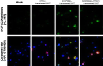 SH3PXD2A Antibody in Immunohistochemistry (Paraffin) (IHC (P))