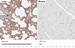 CD9 Antibody in Immunohistochemistry (Paraffin) (IHC (P))