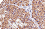 CD9 Antibody in Immunohistochemistry (Paraffin) (IHC (P))