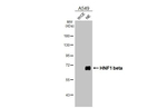 TCF2 Antibody in Western Blot (WB)