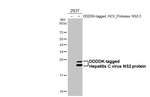 Hepatitis C Virus NS2 Antibody in Western Blot (WB)