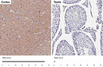 GABBR2 Recombinant Rabbit Monoclonal Antibody (HL4551)