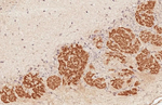 GABBR2 Antibody in Immunohistochemistry (Paraffin) (IHC (P))