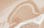 GABBR2 Antibody in Immunohistochemistry (Paraffin) (IHC (P))