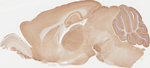 GABBR2 Antibody in Immunohistochemistry (Paraffin) (IHC (P))