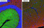 GABBR2 Antibody in Immunohistochemistry (Paraffin) (IHC (P))