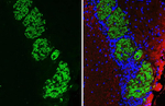 GABBR2 Antibody in Immunohistochemistry (Paraffin) (IHC (P))