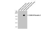 GABBR2 Antibody in Western Blot (WB)