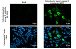 Helicobacter pylori urease B Recombinant Rabbit Monoclonal Antibody (HL4569)