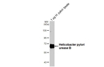 Helicobacter pylori urease B Antibody in Western Blot (WB)