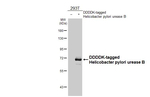 Helicobacter pylori urease B Antibody in Western Blot (WB)