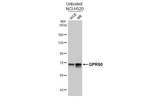 GPR50 Recombinant Rabbit Monoclonal Antibody (HL4628)