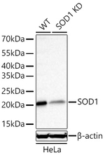 SOD1 Recombinant Rabbit Monoclonal Antibody (2K8W4)