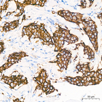 TROP2 Antibody in Immunohistochemistry (Paraffin) (IHC (P))